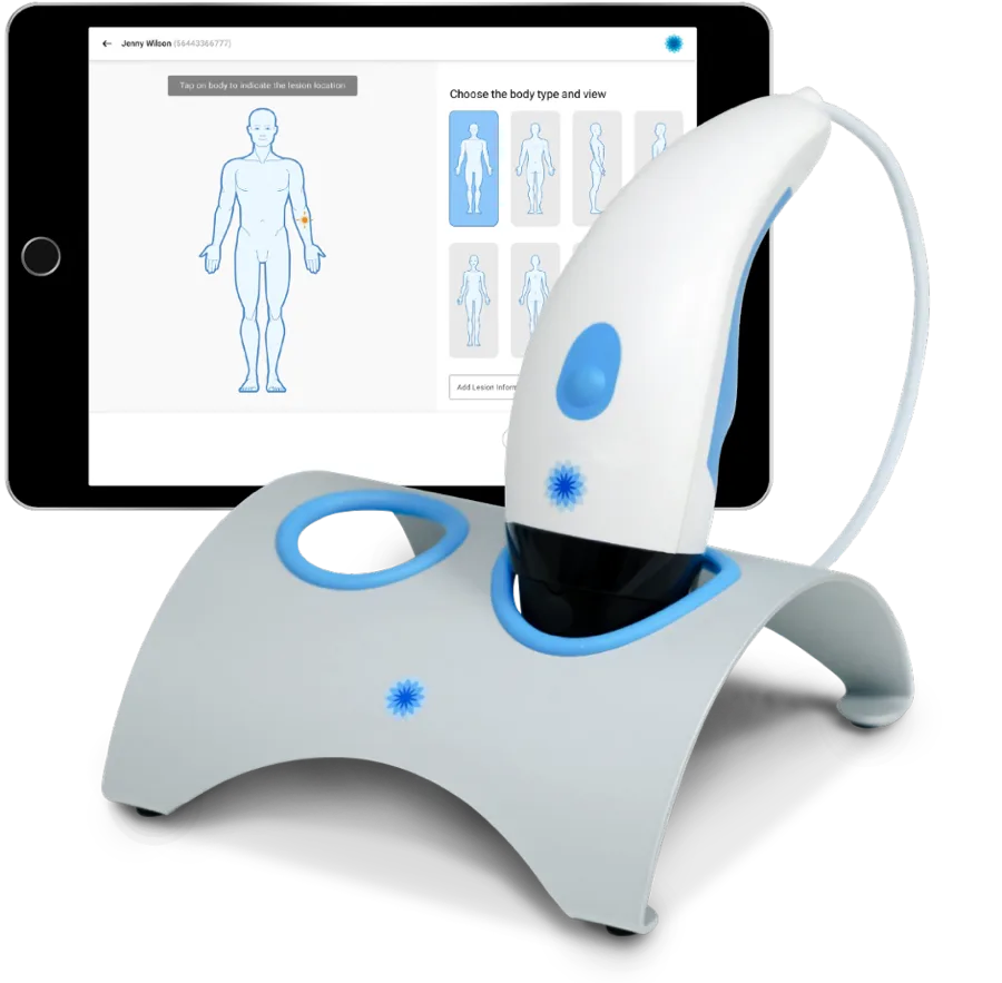 DeepX handheld dermatoscopy device and tablet showing a skin assessment